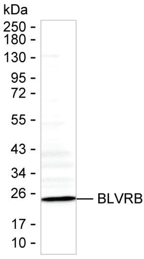 BLVRB